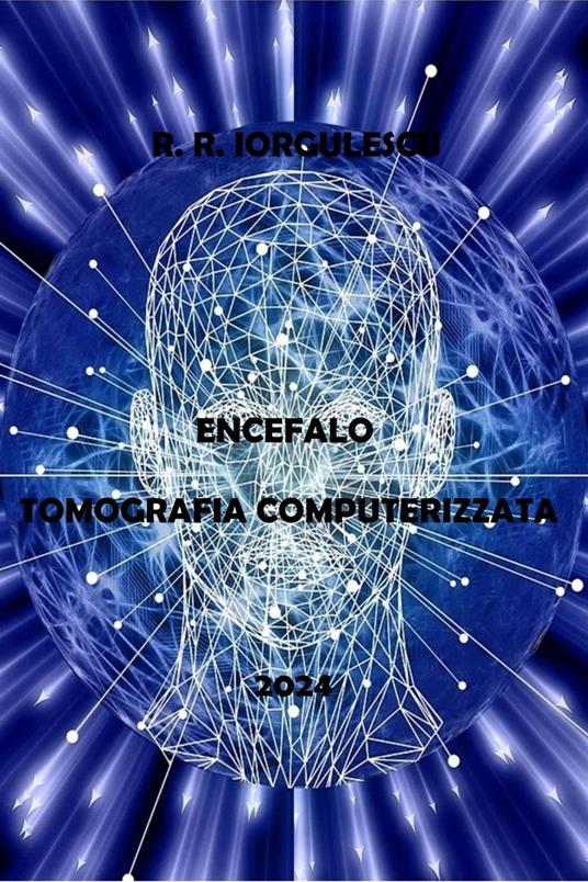 Encefalo - Tomografia Computerizzata - R.R. Iorgulescu - ebook