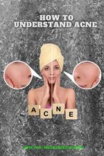 Understanding acne