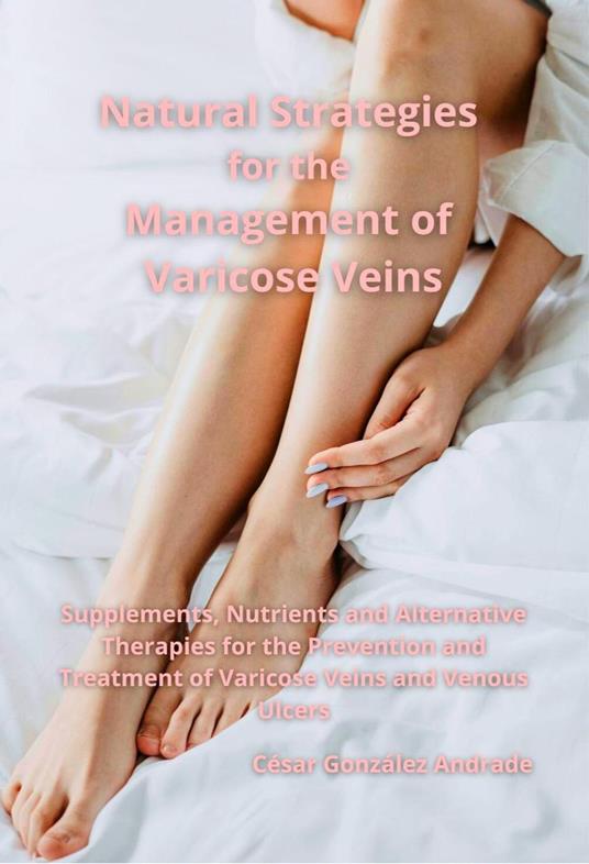 Natural Strategies for the Management of Varicose Veins