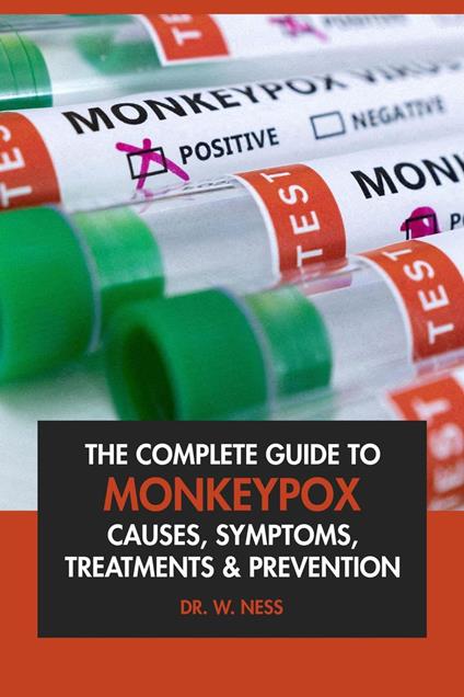 The Complete Guide to Monkeypox: Causes, Symptoms, Treatment & Prevention.