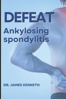 Defeat Ankylosing Spondylitis: Journey Through Ankylosing Spondylitis - James Kenneth - cover