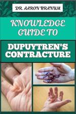 Knowledge Guide to Dupuytren's Contracture: Comprehensive Manual To Symptoms, Treatments, And Preventative Care For Hand Health And Mobility