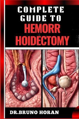 Complete Guide to Hemorrhoidectomy: Comprehensive Handbook To Surgical Treatment, Recovery, Pain Management, And Post Operative Care - Bruno Horan - cover