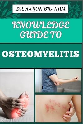 Knowledge Guide to Osteomyelitis: Essential Manual To Diagnosis, Treatment, Prevention, and Advanced Therapies for Bone Infection Management - Aaron Branum - cover