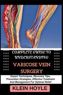 Complete Guide to Understanding Varicose Vein Surgery: Expert Techniques, Recovery Tips, Prevention Strategies, Effective Treatment And Management For Optimal Relief - Klein Hoyle - cover