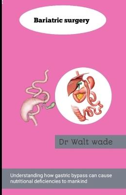 Bariatric surgery: Understand How gastric bypass can cause nutritional deficiencies to mankind - Walt Wade - cover