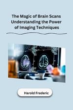 The Magic of Brain Scans Understanding the Power of Imaging Techniques