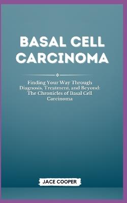 Basal Cell Carcinoma: Finding Your Way Through Diagnosis, Treatment, and Beyond: The Chronicles of Basal Cell Carcinoma - Jace Cooper - cover