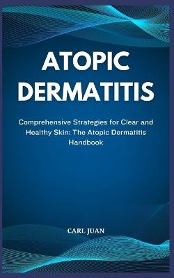 Atopic Dermatitis: Comprehensive Strategies for Clear and Healthy Skin: The Atopic Dermatitis Handbook - Carl Juan - cover