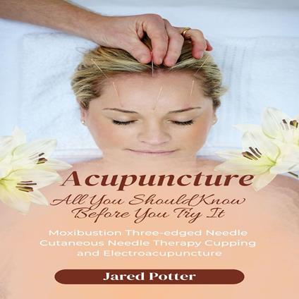 Acupuncture: All You Should Know Before You Try It (Moxibustion Three-edged Needle Cutaneous Needle Therapy Cupping and Electroacupuncture)