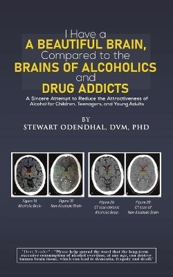 I Have a Beautiful Brain, Compared to the Brains of Alcoholics and Drug Addicts: A Sincere Attempt to Reduce the Attractiveness of Alcohol for Children, Teenagers, and Young Adults - Stewart Odendhal, DVM, PhD - cover