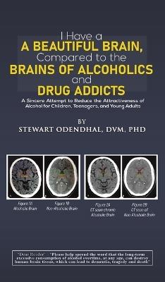 I Have a Beautiful Brain, Compared to the Brains of Alcoholics and Drug Addicts: A Sincere Attempt to Reduce the Attractiveness of Alcohol for Children, Teenagers, and Young Adults - Stewart Odendhal, DVM, PhD - cover